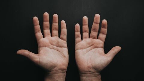 Lecci&oacute;n de anatom&iacute;a: &iquest;qu&eacute; es la tabaquera anat&oacute;mica?