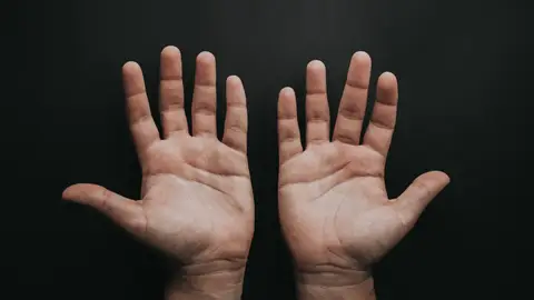 Imagen de unas manos Lección de anatomía: ¿qué es la tabaquera anatómica?