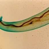Angiostrongylus cantonensis, gusano pulmonar de las ratas