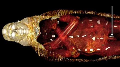 Los amuletos se colocaron sobre esta momia o en su interior dispuestos en tres columnas. Los amuletos se colocaron sobre esta momia o en su interior dispuestos en tres columnas.