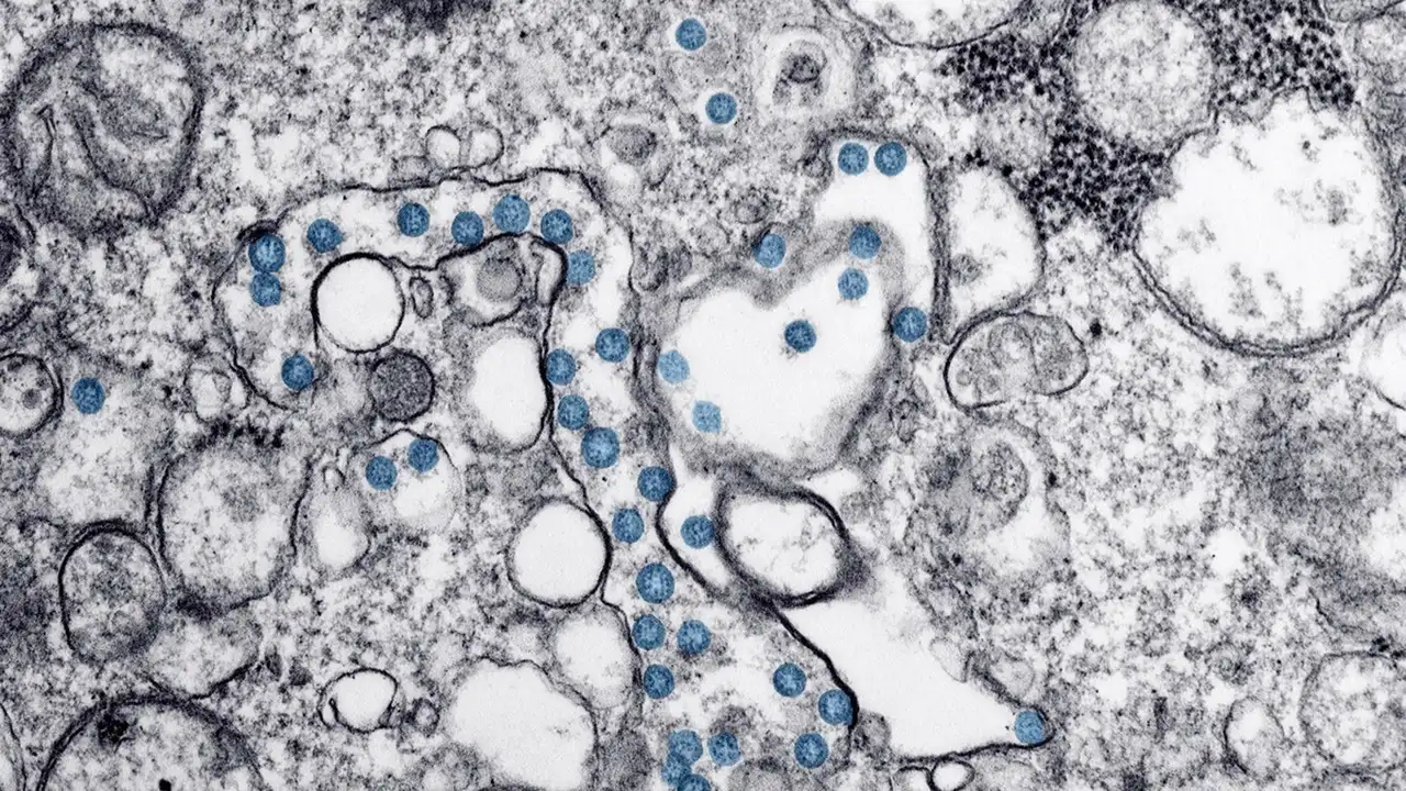 Partículas del virus SARS-CoV-2, coloreadas en azul, en una imagen de microscopio de electrones. Imagen cedida por el Consejo Superior de Investigaciones Científicas (CSIC) Partículas del virus SARS-CoV-2, coloreadas en azul, en una imagen de microscopio de electrones. Imagen cedida por el Consejo Superior de Investigaciones Científicas (CSIC)