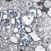 Partículas del virus SARS-CoV-2, coloreadas en azul, en una imagen de microscopio de electrones. Imagen cedida por el Consejo Superior de Investigaciones Científicas (CSIC)