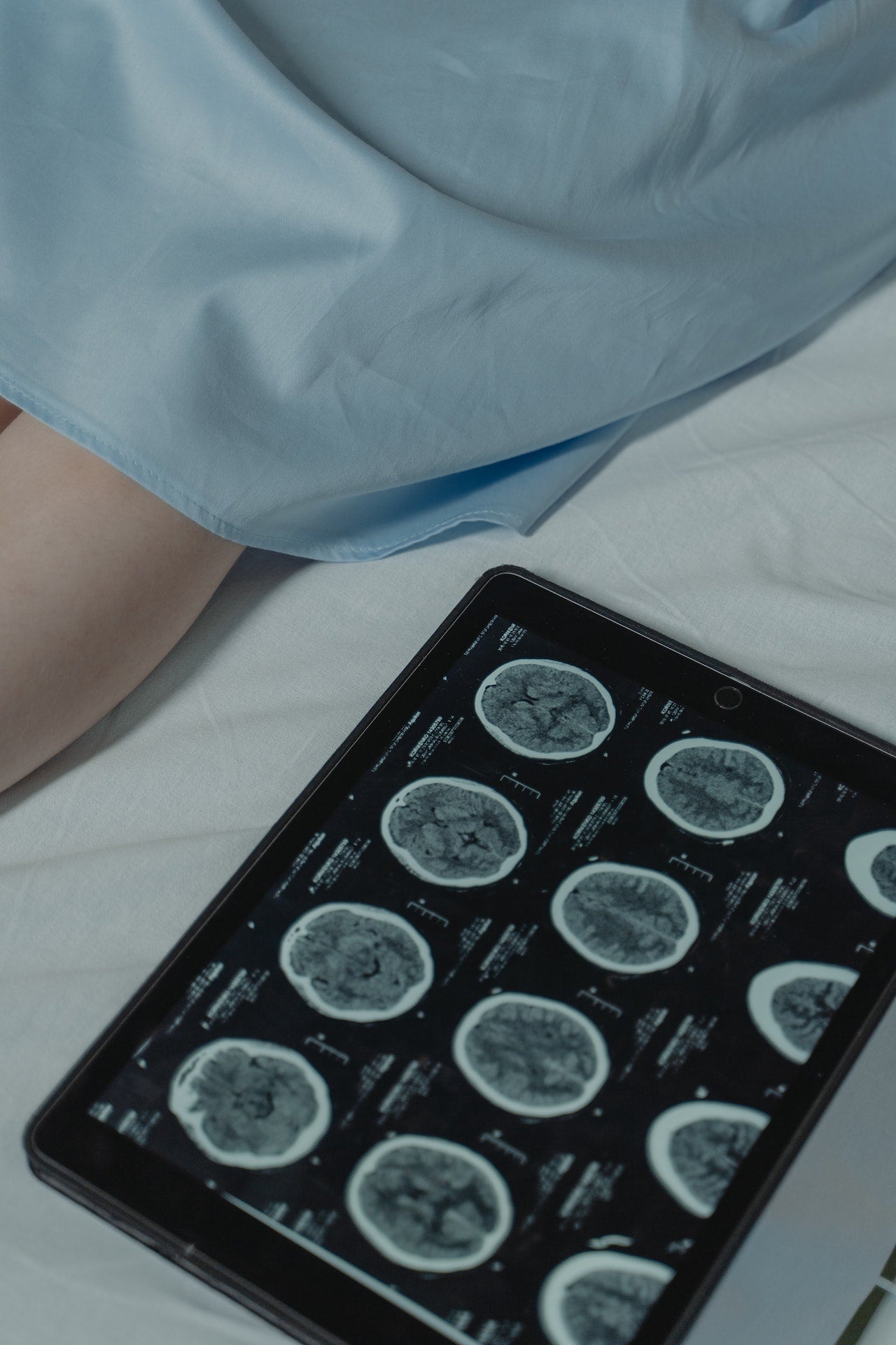 Cuál es el origen del cáncer y por qué es tan difícil de curar Cuál es el origen del cáncer y por qué es tan difícil de curar