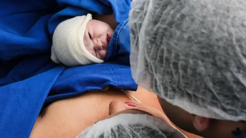 Satse Catalunya alerta de la manca de llevadores Satse Catalunya alerta de la manca de llevadores