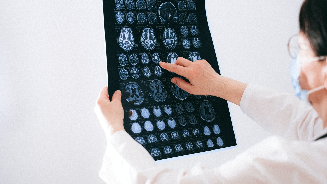 Cientistas descobrem marcadores cerebrais de dor crônica, uma ‘epidemia silenciosa’