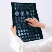 Científicos descubren los marcadores cerebrales del dolor crónico, una "epidemia silenciosa"