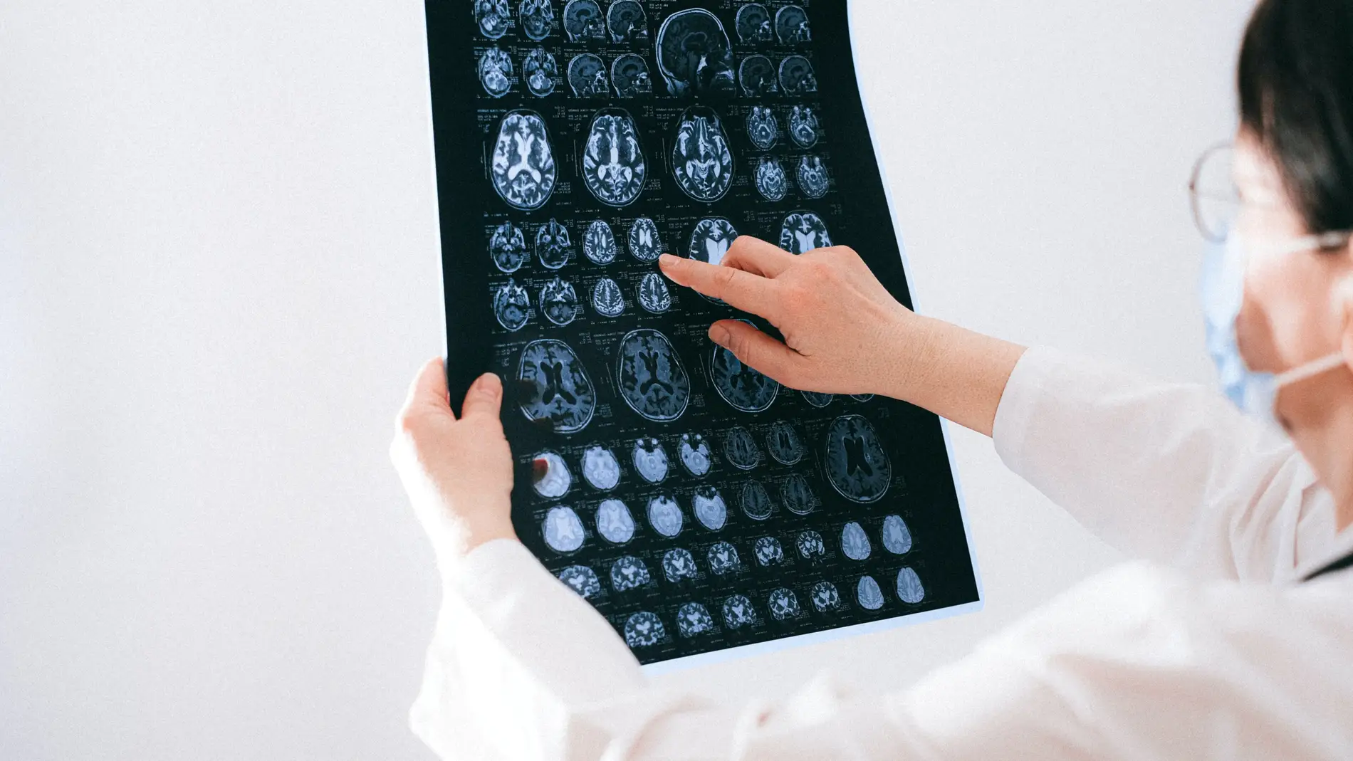 Científicos descubren los marcadores cerebrales del dolor crónico, una "epidemia silenciosa"