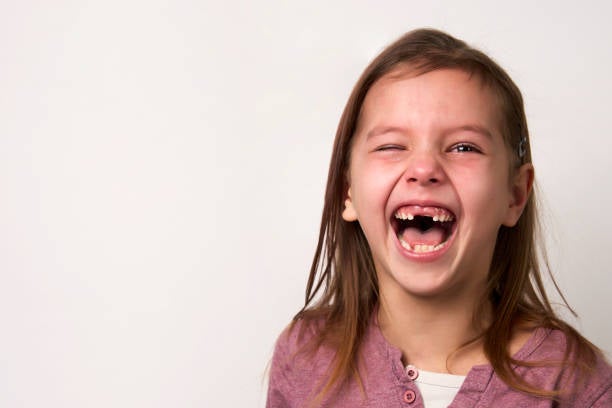 03X11 Dientes definitivos 03X11 Dientes definitivos