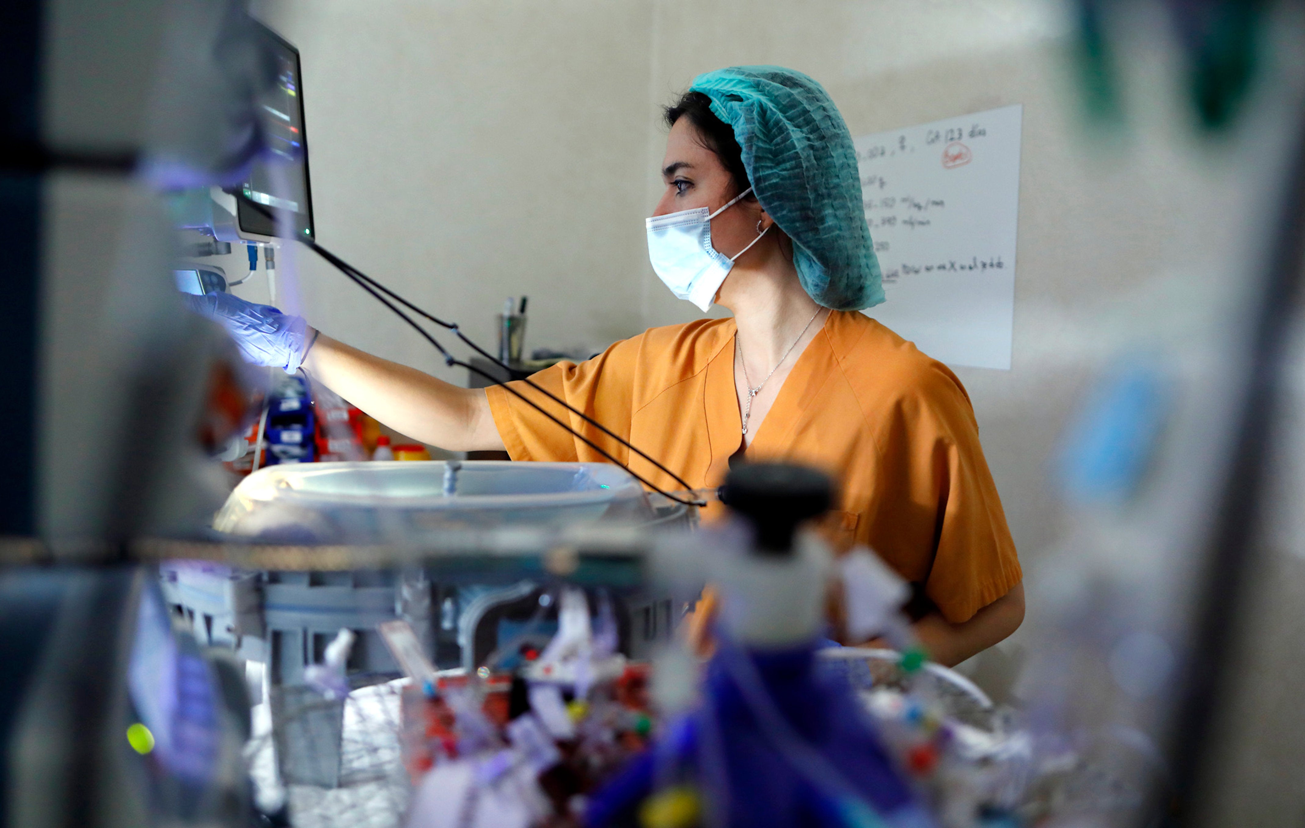 Investigadores han conseguido que un feto de oveja sobreviva 12 días en una placenta artificial Investigadores han conseguido que un feto de oveja sobreviva 12 días en una placenta artificial