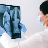 Una médico examina una radiografía de pulmón en una imagen de archivo