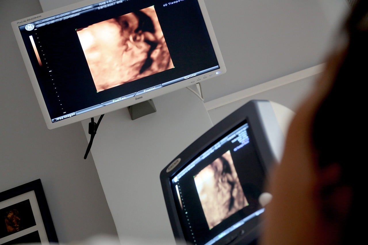 Los bebés fallecidos antes de nacer con más de 6 meses de gestación serán inscritos desde hoy en el Registro Civil Los bebés fallecidos antes de nacer con más de 6 meses de gestación serán inscritos desde hoy en el Registro Civil
