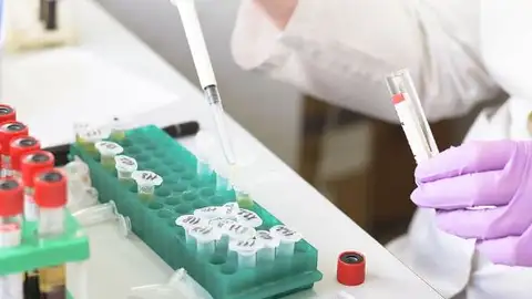 ¿Qué nos indica el color de la orina? en buenas manos