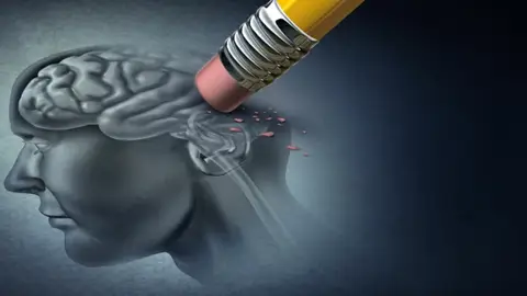 ALZHEIMER ALZHEIMER
