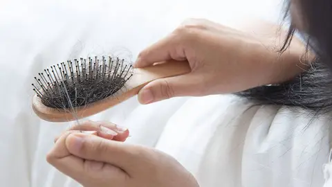 Caída del cabello en otoño Caída del cabello en otoño