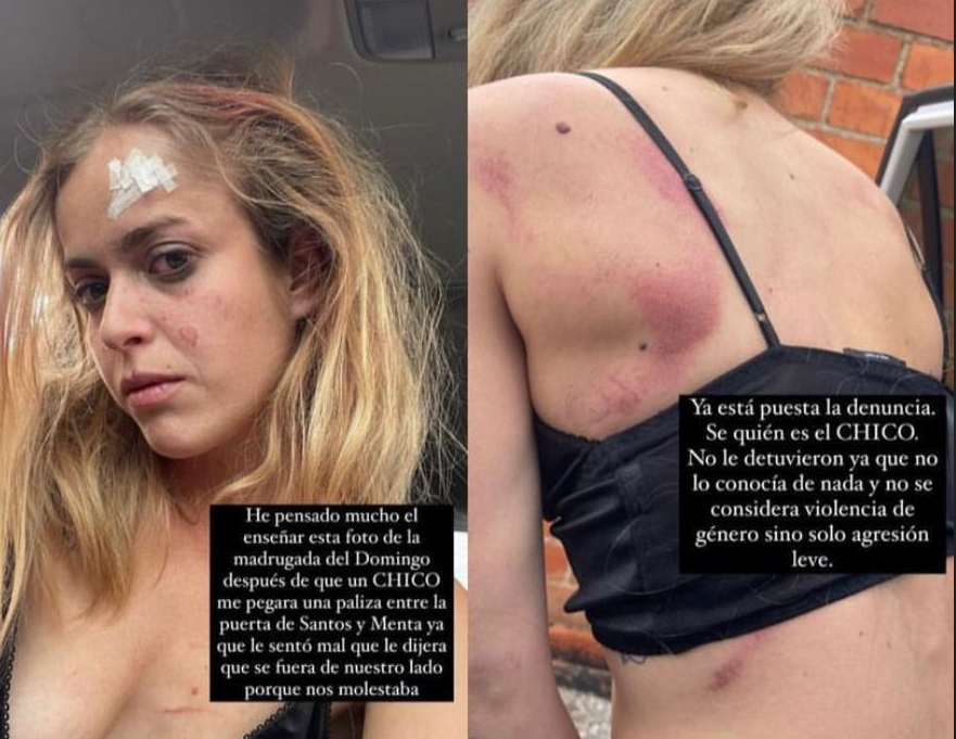 Una joven denuncia en Instagram una brutal agresión este pasado fin de semana en Castelló Una joven denuncia en Instagram una brutal agresión este pasado fin de semana en Castelló