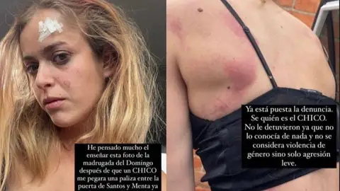 Una joven denuncia en Instagram una agresión sufrida el pasado fin de semana en Castelló Una joven denuncia en Instagram una agresión sufrida el pasado fin de semana en Castelló