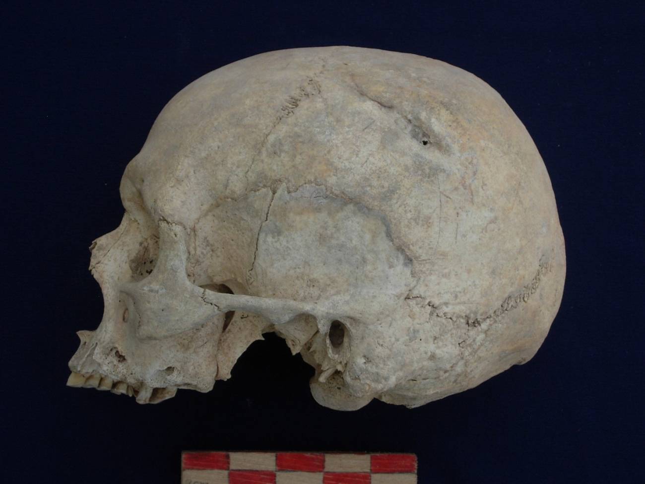 Hace 6000 años se alcanzó el punto más álgido de violencia entre humanos. Hace 6000 años se alcanzó el punto más álgido de violencia entre humanos.