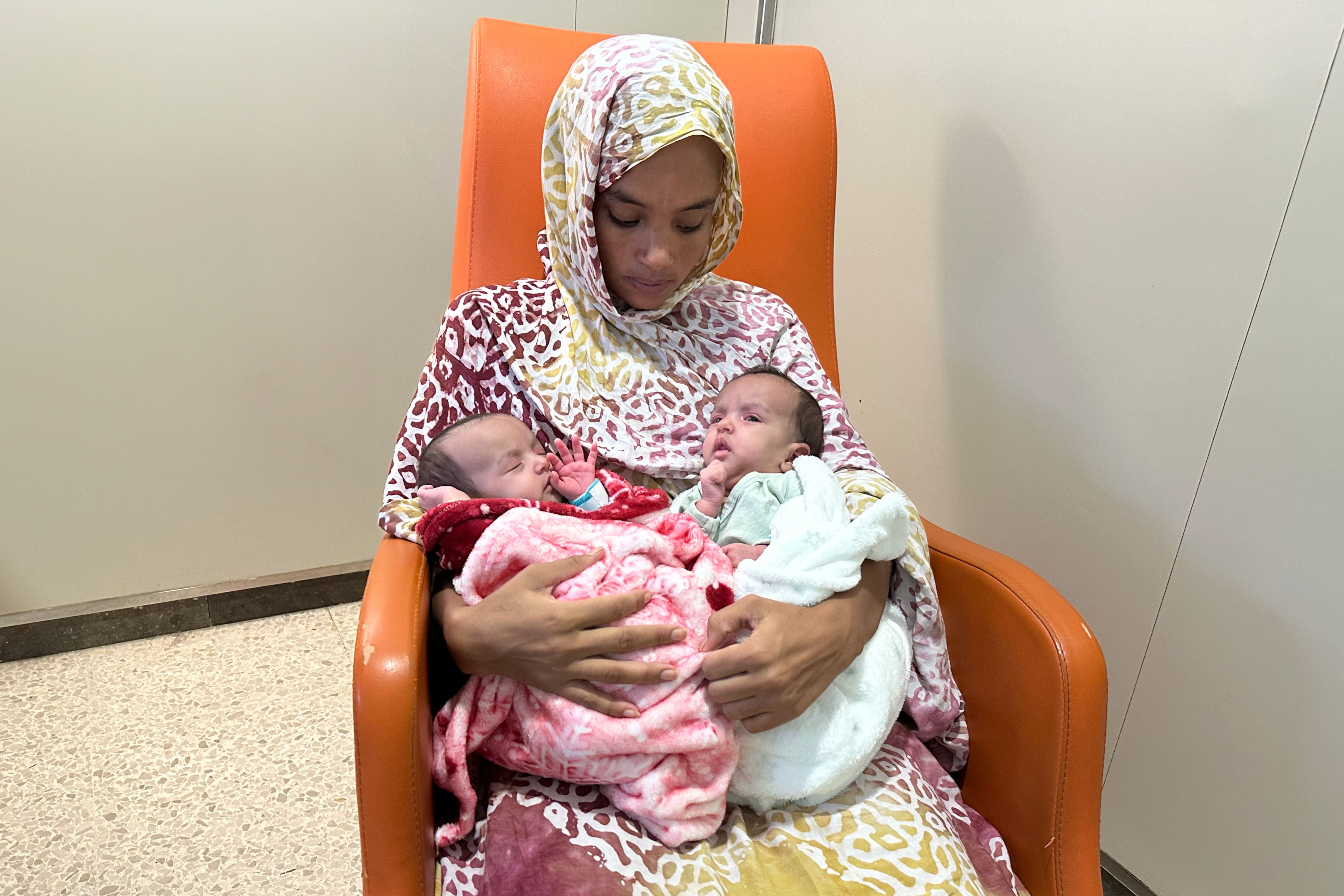 El Sant Joan de Déu opera amb èxit dues germanes siameses unides per l'abdomen El Sant Joan de Déu opera amb èxit dues germanes siameses unides per l'abdomen