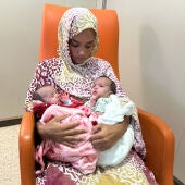 Dues germanes siameses de Mauritània han estat separades amb èxit a l'hospital Sant Joan de Déu.