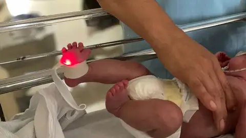 Bebé prematuro en una unidad de neonatología Bebé prematuro en una unidad de neonatología