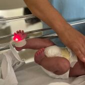 Bebé prematuro en una unidad de neonatología