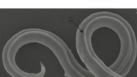 https:www.elconfidencial.com/tecnologia/ciencia/2023-08-01/gusano-vuelve-vida-46000-anos-despues-permafrost_3711064/ https:www.elconfidencial.com/tecnologia/ciencia/2023-08-01/gusano-vuelve-vida-46000-anos-despues-permafrost_3711064/