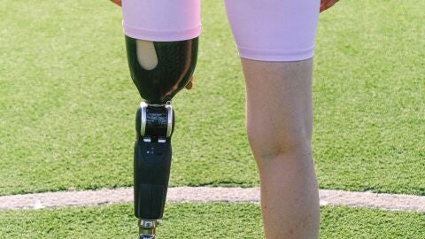 Mujer con una pr&oacute;tesis