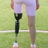 Mujer con una prótesis