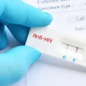 Prueba rápida VIHvik Prueba rápida VIHvik