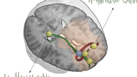 materia blanca en el cerebro