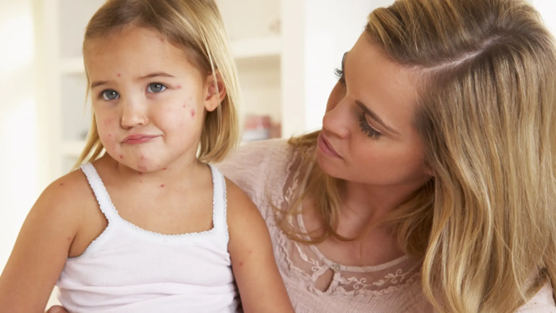Dos de cada cinco casos de sarampión se dan en niños de 1 a 4 años
