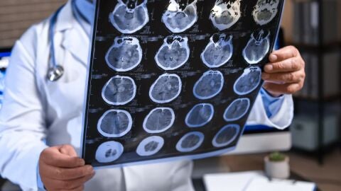 Sigue el colapso en el servicio de Neurología de Villajoyosa (Alicante) Sigue el colapso en el servicio de Neurología de Villajoyosa (Alicante)