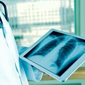 Médico mirando una radiografía de pulmón