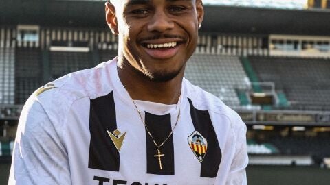 Douglas Aurelio 