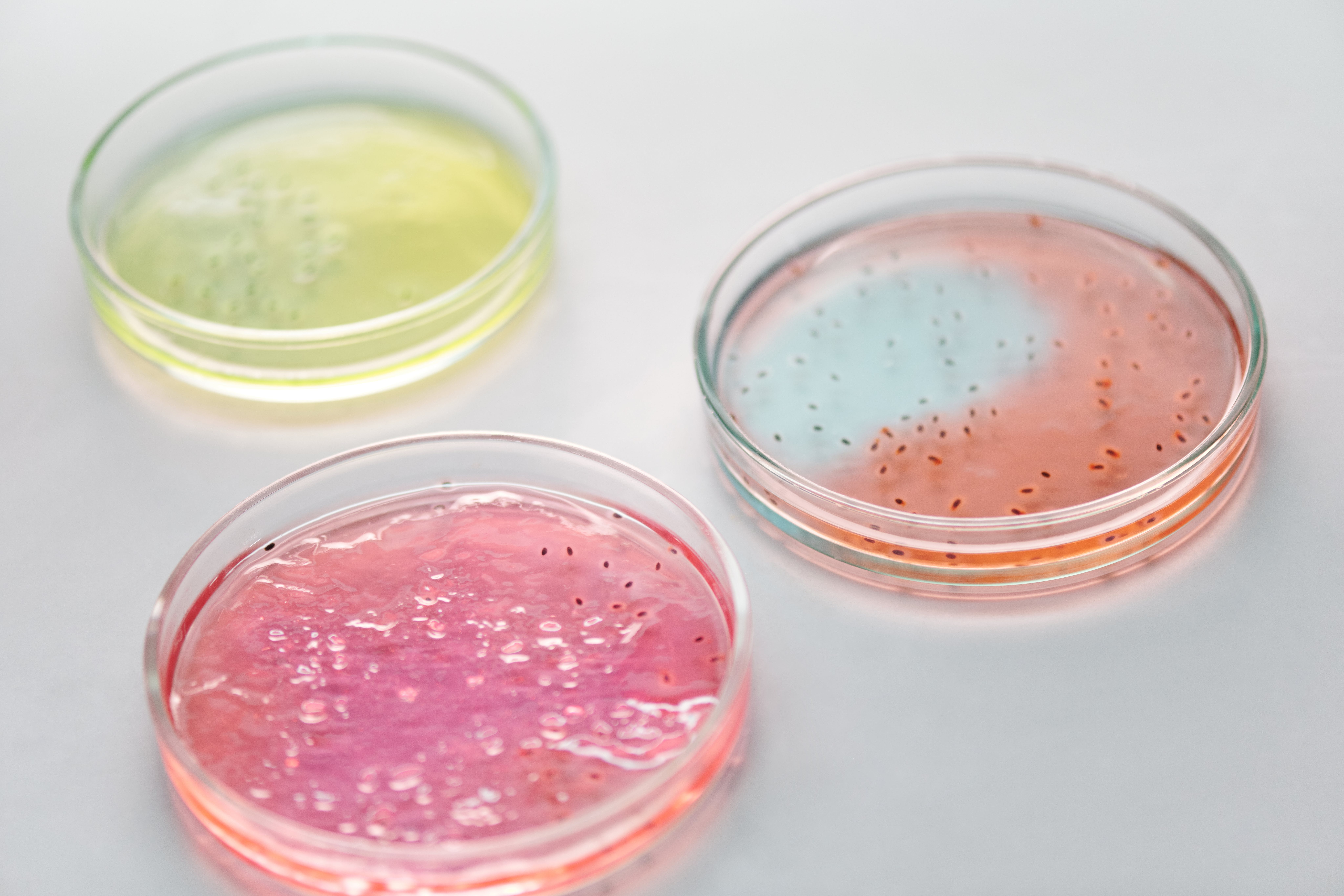 Los microbios responsables de la descomposición humana podrían ayudar a determinar la hora de la muerte Los microbios responsables de la descomposición humana podrían ayudar a determinar la hora de la muerte