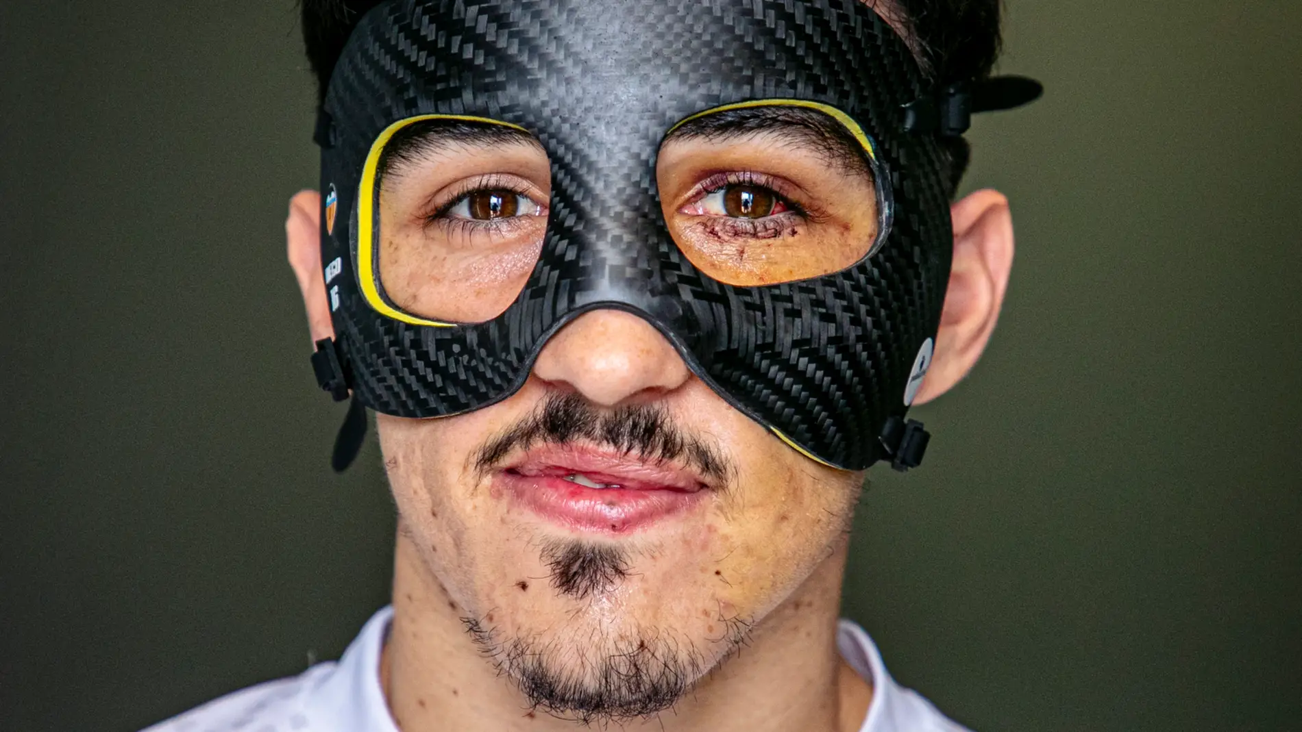 Diego López ya luce máscara en los entrenamientos del Valencia