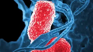 Glóbulos blancos (azul) atacan a dos bacterias 'Klebsiella' (rosa) en esta imagen microscópica electrónica de barrido coloreada.