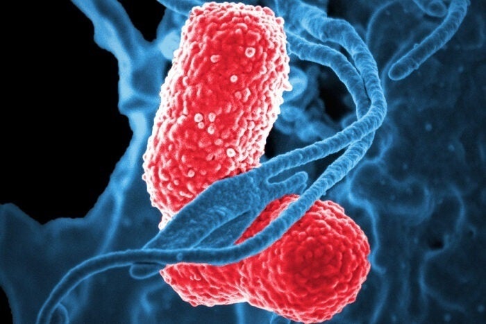 El ECDC alerta del aumento en Europa de una bacteria potencialmente mortal que resiste a los medicamentos El ECDC alerta del aumento en Europa de una bacteria potencialmente mortal que resiste a los medicamentos