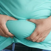 La obesidad afecta en España a uno de cada cinco adultos y al 10% de los niños La obesidad afecta en España a uno de cada cinco adultos y al 10% de los niños