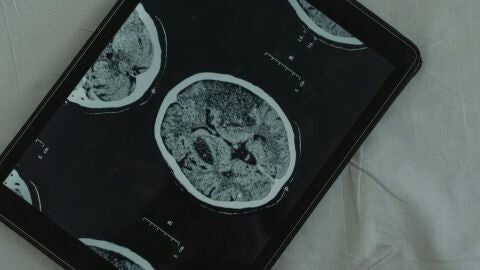 Una radiograf&iacute;a de varios cerebros 