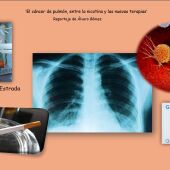 ‘El cáncer de pulmón, entre la nicotina y las nuevas terapias’