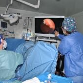 El Hospital General de Castellón activa un nuevo quirófano para rebajar la demora de intervenciones