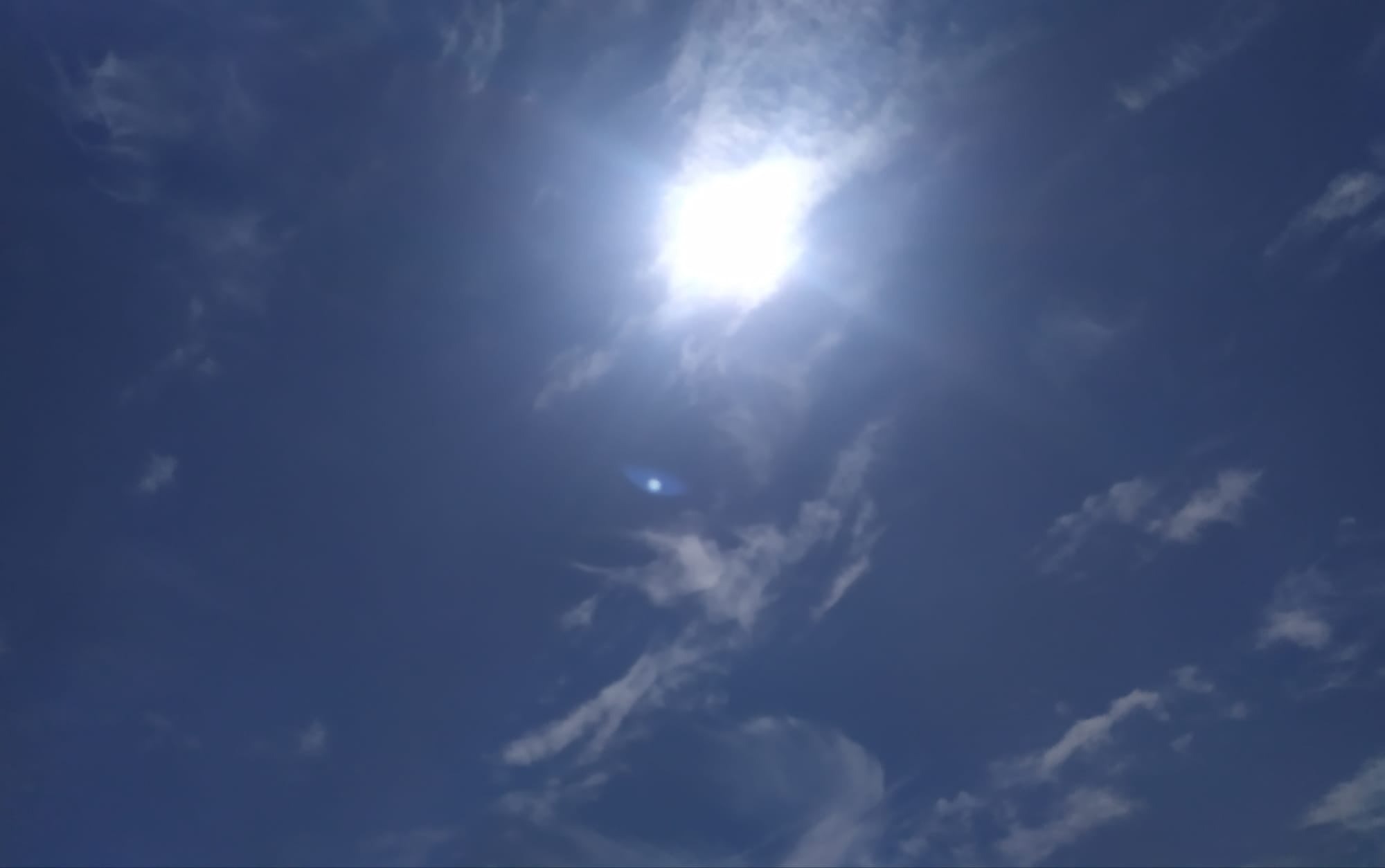 Las claves para prevenir y tratar las manchas solares con Centro Dermatológico Estético de Alicante Las claves para prevenir y tratar las manchas solares con Centro Dermatológico Estético de Alicante