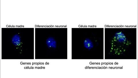Células madre y células en proceso de diferenciación a neuronas (núcleos en azul y ARN mensajeros en verde).