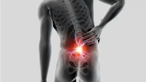 Hernia de disco Hernia de disco