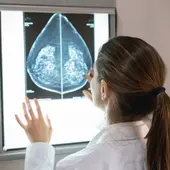 cáncer de mama, diagnóstico cáncer de mama, diagnóstico
