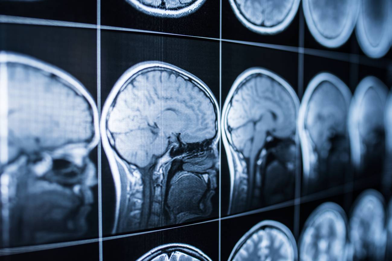 "A veces, el cerebro toma atajos para construir la realidad" "A veces, el cerebro toma atajos para construir la realidad"
