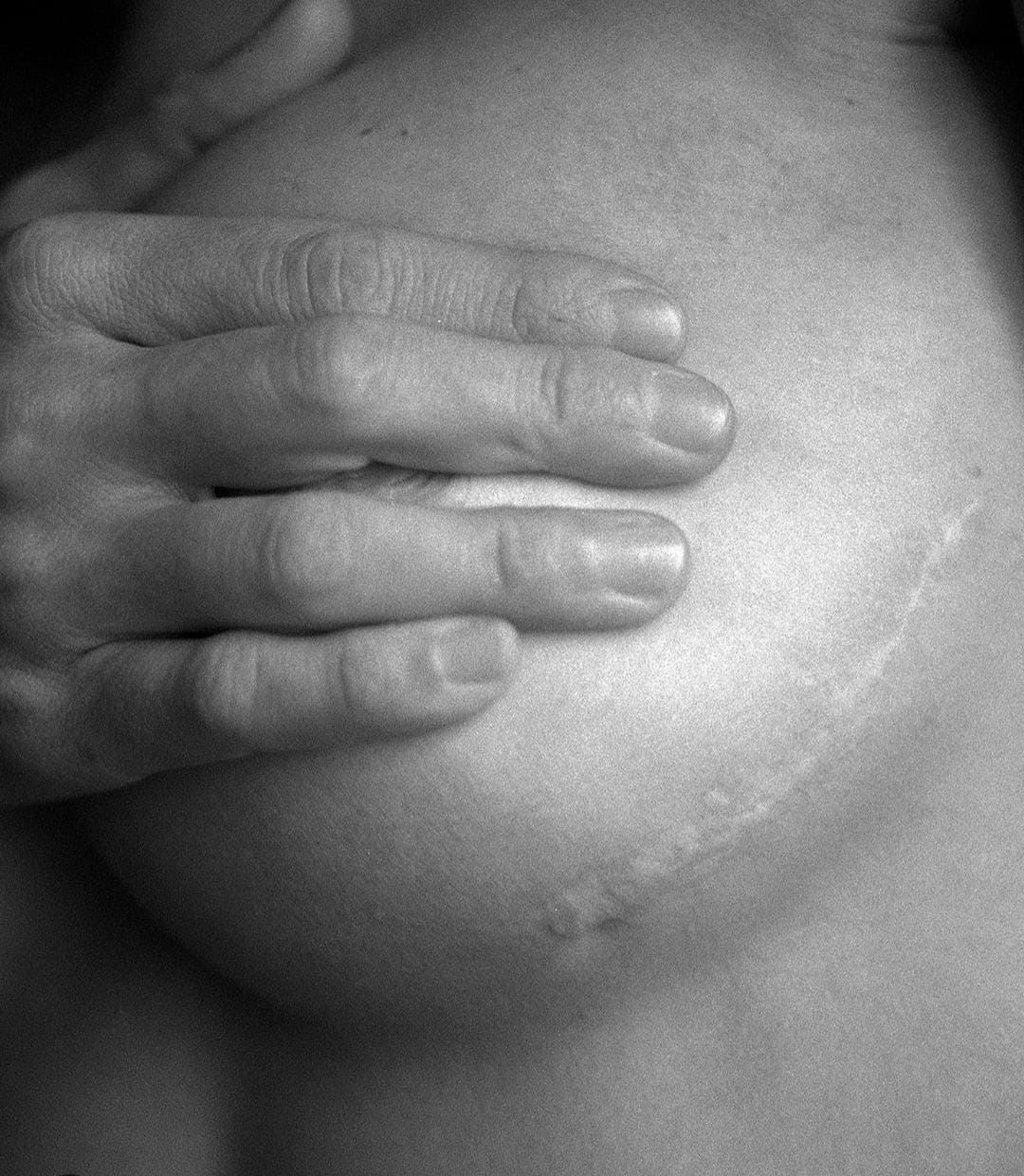 Ejercicio y Salud 16/05/2024 (Ejercicio en pacientes oncológicos) Ejercicio y Salud 16/05/2024 (Ejercicio en pacientes oncológicos)