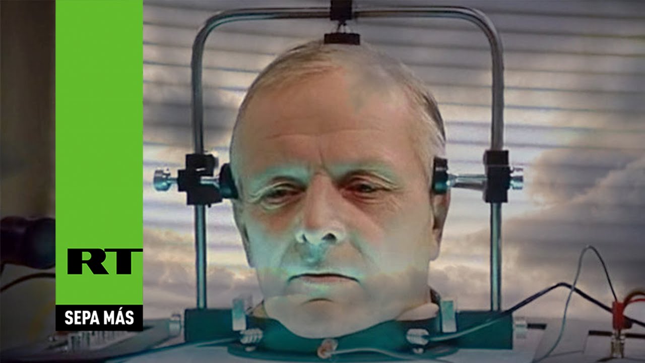 ¿Si te dieran la opción harías un trasplante de cabeza? ¿Si te dieran la opción harías un trasplante de cabeza?