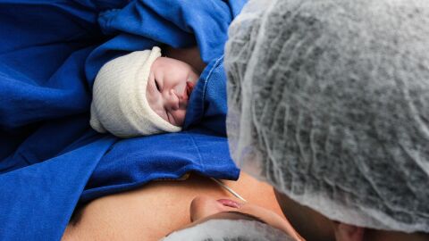 El hospital HLA La Vega permite el acompañamiento en partos por cesárea